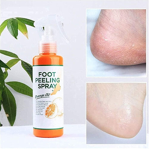 Foot Peeling Spray with Orange Oil Essence for Dead Skin Exfoliation